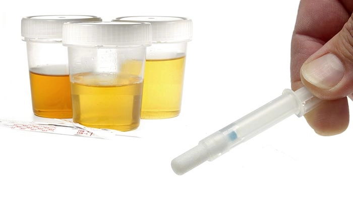 best synthetic urine kits